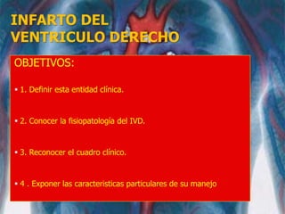 INFARTO DEL
VENTRICULO DERECHO
OBJETIVOS:
 1. Definir esta entidad clínica.
 2. Conocer la fisiopatología del IVD.
 3. Reconocer el cuadro clínico.
 4 . Exponer las caracteristicas particulares de su manejo
 