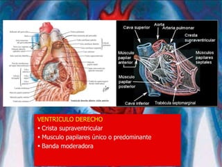 VENTRICULO DERECHO
 Crista supraventricular
 Musculo papilares único o predominante
 Banda moderadora
 