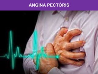 ANGINA PECTÓRIS
 