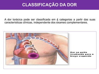 CLASSIFICAÇÃO DA DOR
A dor torácica pode ser classificada em 4 categorias a partir das suas
características clínicas, independente dos exames complementares.
 