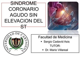 SINDROME
CORONARIO
AGUDO SIN
ELEVACION DEL
ST
Facultad de Medicina
 Sergio Cadavid Asis
TUTOR:
 Dr. Mario Villareal
 