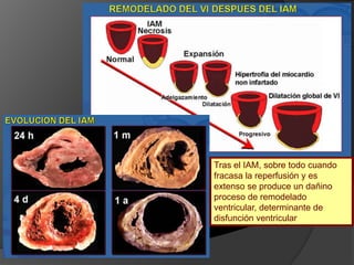 El modo en el que podemos establecer que se ha producido necrosis miocárdica es la determinación de los niveles en plasma de distinto marcadores biológicos de daño miocárdico