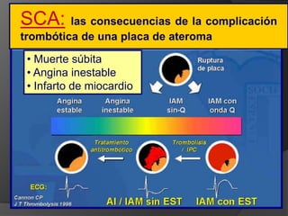 EMIATUna gran cicatriz del IAM, sobre todo sin reperfusión es el sustrato propicio para el desarrollo de arritmias ventriculares malignasDentro de los pacientes con arritmias, que son un grupo de alta mortalidad, también el severo deterioro de la función ventricular es el principal predictor de muerte.