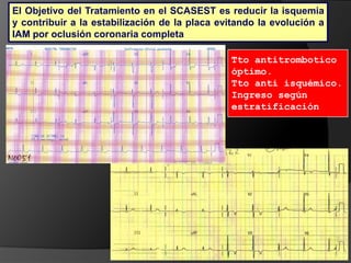  La oclusión coronaria determina un riesgo importante de morir en los días siguientes, sobre todo en los momentos inmediatos a la obstrucción, antes de llegar al hospital.