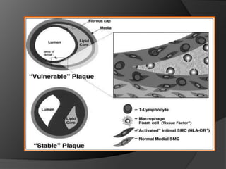 Atraccion de leucocitos