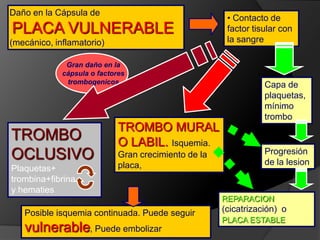 Deposito de una capa de plaquetasSuficienteHDL Poco HDL o mucho LDLLos  leucocitos sacan LDL a la circulaciónLos  leucocitos se cargan de lipidos (celulas espumosas).Incapaces de ir captando todo el colesterol, se hinchan y  se necrosan . El LDL se oxidadesencadenando una compleja respuesta inflamatoria. PLACA VULNERABLEREPARACION con mas o menos cicatrizREGRESIONEvolucion a PLACA ESTABLE con cápsula gruesa y colesterol cristalizado
