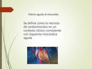 Infarto agudo al miocardio
Se define como la necrosis
de cardiomiocitos en un
contexto clínico consistente
con isquemia miocárdica
aguda
 