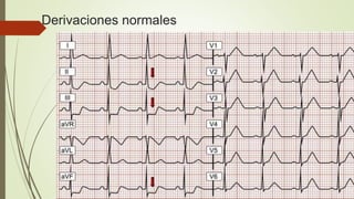 Derivaciones normales
 