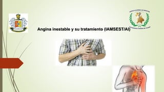 Angina inestable y su tratamiento (IAMSEST/AI)
 