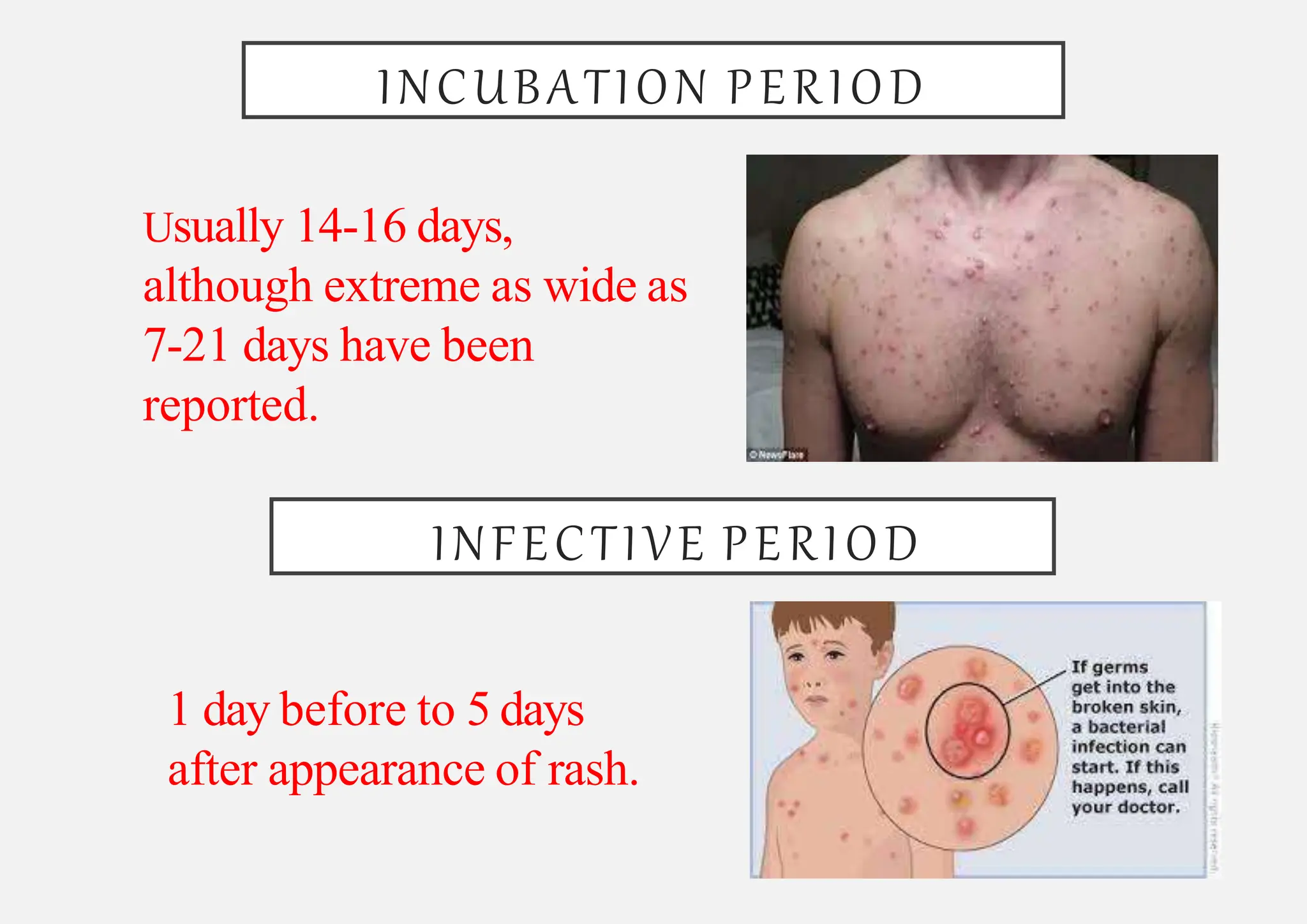 Chickenpox Department of Physiotherapy, SHUATS, Prayagraj | PPTX