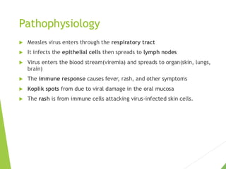 Measles Introduction Measles(introduction, Epidemiology Etiology , Pathophsyalogy ...