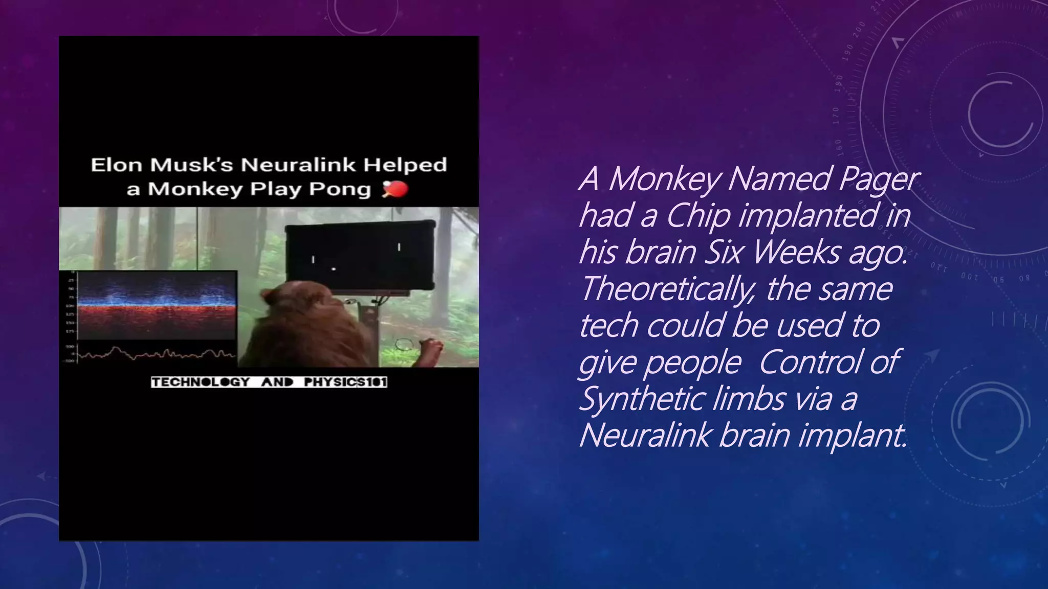 A Monkey Named Pager
had a Chip implanted in
his brain Six Weeks ago.
Theoretically, the same
tech could be used to
give people Control of
Synthetic limbs via a
Neuralink brain implant.
 