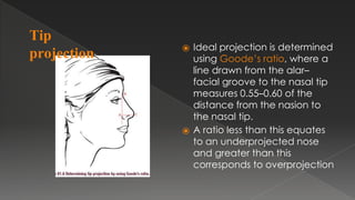 ⦿ Ideal projection is determined
using Goode’s ratio, where a
line drawn from the alar–
facial groove to the nasal tip
measures 0.55–0.60 of the
distance from the nasion to
the nasal tip.
⦿ A ratio less than this equates
to an underprojected nose
and greater than this
corresponds to overprojection
Tip
projection:
 