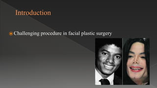 Introduction
⦿ Challenging procedure in facial plastic surgery
 