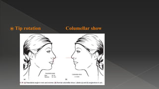⦿ Tip rotation Columellar show
 