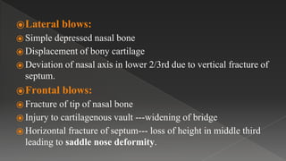 ⦿Lateral blows:
⦿ Simple depressed nasal bone
⦿ Displacement of bony cartilage
⦿ Deviation of nasal axis in lower 2/3rd due to vertical fracture of
septum.
⦿Frontal blows:
⦿ Fracture of tip of nasal bone
⦿ Injury to cartilagenous vault ---widening of bridge
⦿ Horizontal fracture of septum--- loss of height in middle third
leading to saddle nose deformity.
 