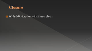Closure
⦿ With 6-0 vicryl or with tissue glue.
 
