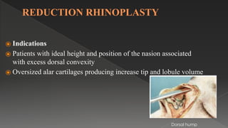 REDUCTION RHINOPLASTY
⦿ Indications
⦿ Patients with ideal height and position of the nasion associated
with excess dorsal convexity
⦿ Oversized alar cartilages producing increase tip and lobule volume
Dorsal hump
 