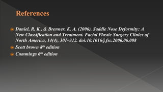 References
⦿ Daniel, R. K., & Brenner, K. A. (2006). Saddle Nose Deformity: A
New Classification and Treatment. Facial Plastic Surgery Clinics of
North America, 14(4), 301–312. doi:10.1016/j.fsc.2006.06.008
⦿ Scott brown 8th edition
⦿ Cummings 6th edition
 