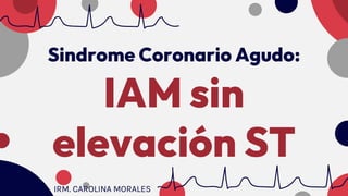 Sindrome Coronario Agudo:
IAM sin
elevación ST
IRM. CAROLINA MORALES