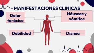 MANIFESTACIONES CLINICAS
Dolor
torácico
Debilidad
Náuseas y
vómitos
Disnea