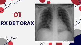 RX DE TORAX
01