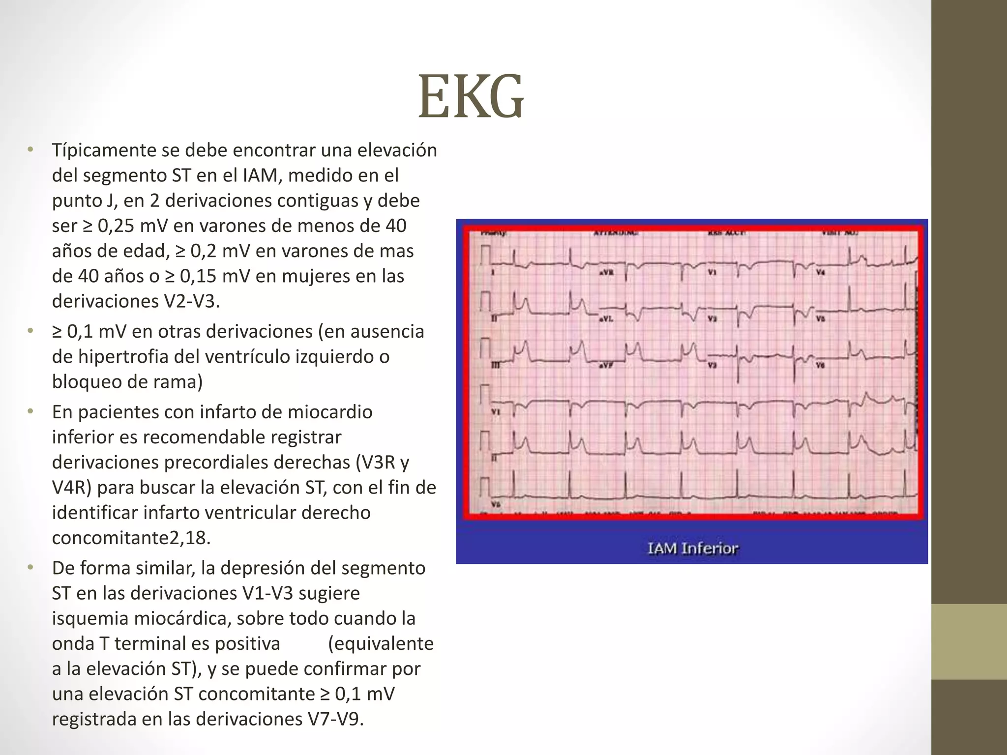 Infarto agudo al miocardio con elevacion del segmento ST | PPTX