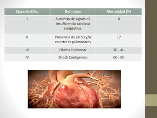 Clase de Killip Definición Mortalidad (%)
I Ausencia de signos de
insuficiencia cardíaca
congestiva.
6
II Presencia de un S3 y/o
estertores pulmonares
17
III Edema Pulmonar 30 - 40
IV Shock Cardigénico 60 - 80
 