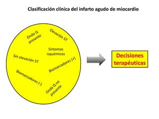 Clasificación clínica del infarto agudo de miocardio
Síntomas
isquémicos
Decisiones
terapéuticas
 