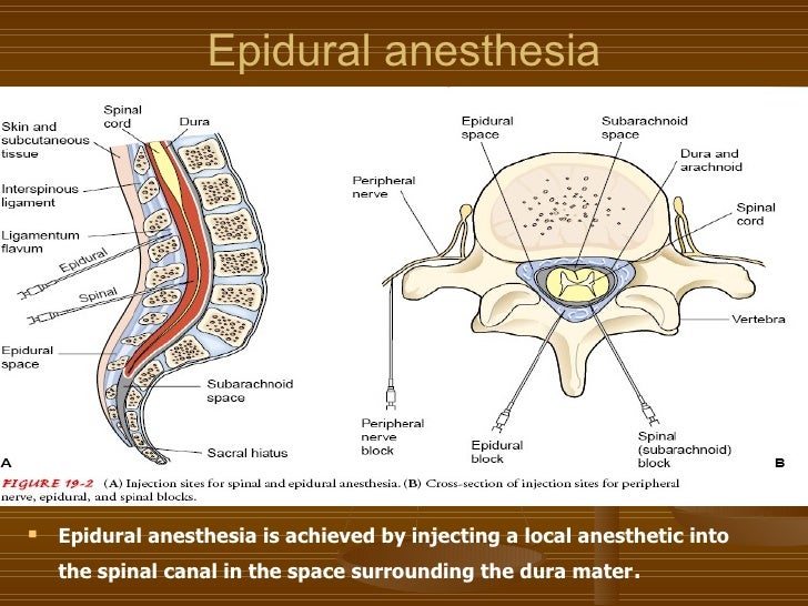 sedation and anesthesia