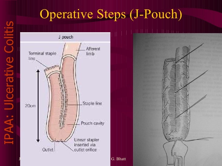 IAPP By Department of Surgery PDU Medical College