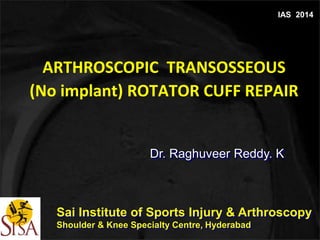 IAS 2014 
ARTHROSCOPIC TRANSOSSEOUS 
(No implant) ROTATOR CUFF REPAIR 
Dr. Raghuveer Reddy. K 
Sai Institute of Sports Injury & Arthroscopy 
Shoulder & Knee Specialty Centre, Hyderabad 
 