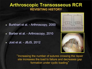 Arthroscopic Transosseous RCR 
REVISITING HISTORY 
● Burkhart et al. - Arthroscopy, 2000 
● Barber et al. - Arthroscopy, 2010 
● Jost et al. - JBJS, 2012 
“Increasing the number of sutures crossing the repair 
site increases the load to failure and decreases gap 
formation under cyclic loading” 
 