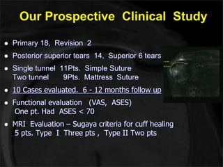 Our Prospective Clinical Study 
 Primary 18, Revision 2 
 Posterior superior tears 14, Superior 6 tears 
 Single tunnel 11Pts. Simple Suture 
Two tunnel 9Pts. Mattress Suture 
 10 Cases evaluated. 6 - 12 months follow up 
 Functional evaluation (VAS, ASES) 
One pt. Had ASES < 70 
 MRI Evaluation – Sugaya criteria for cuff healing 
5 pts. Type I Three pts , Type II Two pts 
 