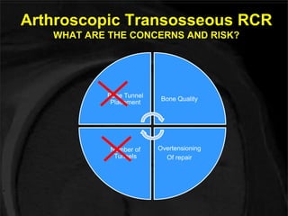 Arthroscopic Transosseous RCR 
WHAT ARE THE CONCERNS AND RISK? 
Bone Tunnel 
Placement 
Bone Quality 
Overtensioning 
Of repair 
Number of 
Tunnels 
 