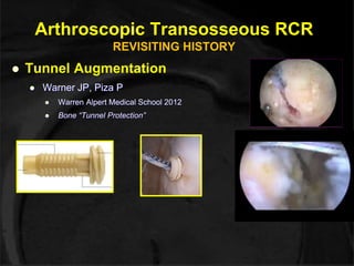 Arthroscopic Transosseous RCR 
REVISITING HISTORY 
 Tunnel Augmentation 
 Warner JP, Piza P 
 Warren Alpert Medical School 2012 
 Bone “Tunnel Protection” 
Courtesy: Warner JP 
 