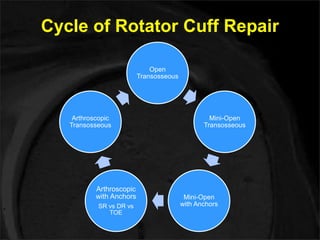 Cycle of Rotator Cuff Repair 
Open 
Transosseous 
Mini-Open 
Transosseous 
Mini-Open 
with Anchors 
Arthroscopic 
Transosseous 
Arthroscopic 
with Anchors 
SR vs DR vs 
TOE 
 
