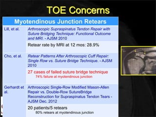 TOE Concerns 
Myotendinous Junction Retears 
Lill, et al. Arthroscopic Supraspinatus Tendon Repair with 
Suture Bridging Technique: Functional Outcome 
and MRI. - AJSM 2010 
Retear rate by MRI at 12 mos: 28.9% 
Cho, et al. Retear Patterns After Arthroscopic Cuff Repair: 
Single Row vs. Suture Bridge Technique. - AJSM 
2010 
27 cases of failed suture bridge technique 
74% failure at myotendinous junction 
Gerhardt et 
al. 
Arthroscopic Single-Row Modified Mason-Allen 
Repair vs. Double-Row SutureBridge 
Reconstruction for Supraspinatus Tendon Tears - 
AJSM Dec. 2012 
20 patients/5 retears 
80% retears at myotendinous junction 
 