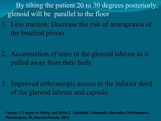 By tilting the patient 20 to 30 degrees posteriorly,
glenoid will be parallel to the floor
1. Less traction: Decrease the risk of neurapraxia of
the brachial plexus
2. Accentuation of tears in the glenoid labrum as it
pulled away from their beds
3. Improved arthroscopic access to the inferior third
of the glenoid labrum and capsule.
Canale, S T, James H. Beaty, and Willis C. Campbell. Campbell's Operative Orthopaedics.
Philadelphia, PA: Elsevier/Mosby, 2013
 