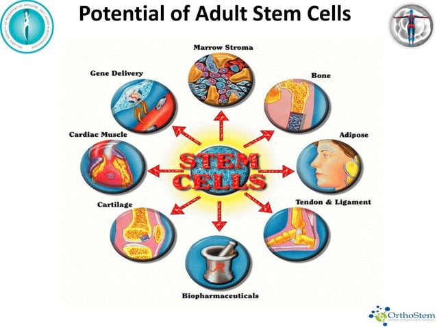 Adult Stem cells in Orthopaedics | PDF | Physical Therapy | Wellness