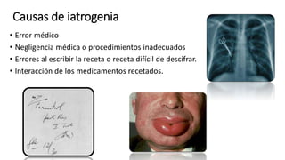 Causas de iatrogenia
• Error médico
• Negligencia médica o procedimientos inadecuados
• Errores al escribir la receta o receta difícil de descifrar.
• Interacción de los medicamentos recetados.
 