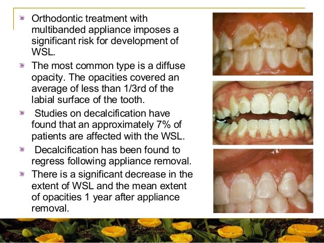Iatrogenic Effects of Orthodontic Treatment DecisionMaking in Prevention Diagnosis and Treatment