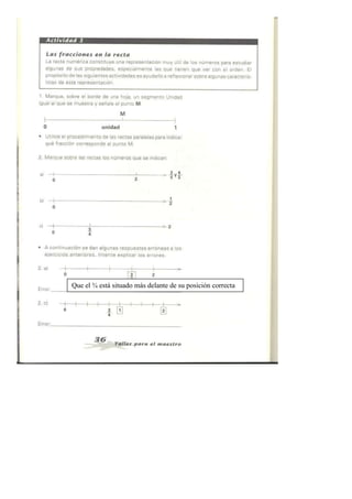 Que el ¾ está situado más delante de su posición correcta
 