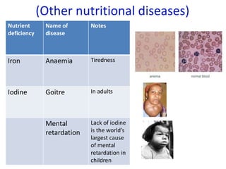 (Other nutritional diseases)
Nutrient
deficiency
Name of
disease
Notes
Iron Anaemia Tiredness
Iodine Goitre In adults
Mental
retardation
Lack of iodine
is the world’s
largest cause
of mental
retardation in
children
 