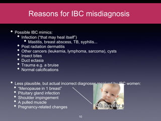 Reasons for IBC misdiagnosis
• Possible IBC mimics:
• Infection (“that may heal itself”)
• Mastitis, breast abscess, TB, syphilis...
• Post radiation dermatitis
• Other cancers (leukemia, lymphoma, sarcoma), cysts
• Insect bites
• Duct ectasia
• Trauma e.g. a bruise
• Normal calcifications
• Less plausible, but actual incorrect diagnoses received by IBC women:
• “Menopause in 1 breast”
• Pituitary gland infection
• Shoulder impingement
• A pulled muscle
• Pregnancy-related changes
10
 