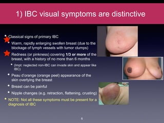1) IBC visual symptoms are distinctive
• Classical signs of primary IBC
• Warm, rapidly enlarging swollen breast (due to the
blockage of lymph vessels with tumor clumps)
• Redness (or pinkness) covering 1/3 or more of the
breast, with a history of no more than 6 months
• (Impt: neglected non-IBC can invade skin and appear like
IBC)
• Peau d’orange (orange peel) appearance of the
skin overlying the breast
• Breast can be painful
• Nipple changes (e.g. retraction, flattening, crusting)
• NOTE: Not all these symptoms must be present for a
diagnosis of IBC
6
 
