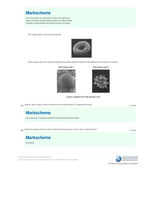 Printed for Dubai American Academy
© International Baccalaureate Organization 2018
International Baccalaureate® - Baccalauréat International® - Bachillerato Internacional®
Markscheme
only some genes are expressed in each cell type/tissue;
tissues therefore develop differently/become differentiated;
example of differentiated cell and the function of tissues;
26a.
This image shows a normal red blood cell.
These images show two red blood cells that have been placed in solutions with different concentrations of solutes.
Deduce, with a reason, which red blood cell has been placed in a hypertonic solution.
Markscheme
cell 2 because it has plasmolized/lost water/volume has decreased
26b. State what change there has been in the cell surface area to volume ratio in red blood cell 1.
Markscheme
decreased
[1 mark]
[1 mark]
 