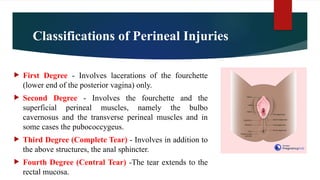 Injuries To Birth Canal Obstetrics And Gynaecological Nursing PPTX injuries-to-birth-canal-obstetrics-and-gynaecological-nursing-pptx