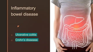 z
Inflammatory
bowel disease
o Ulcerative colitis
o Crohn’s dissease
 