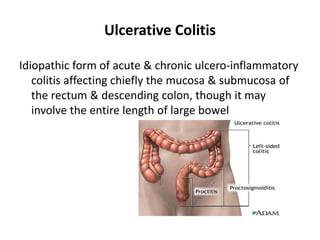 Inflammatory Bowel Disease | PPT